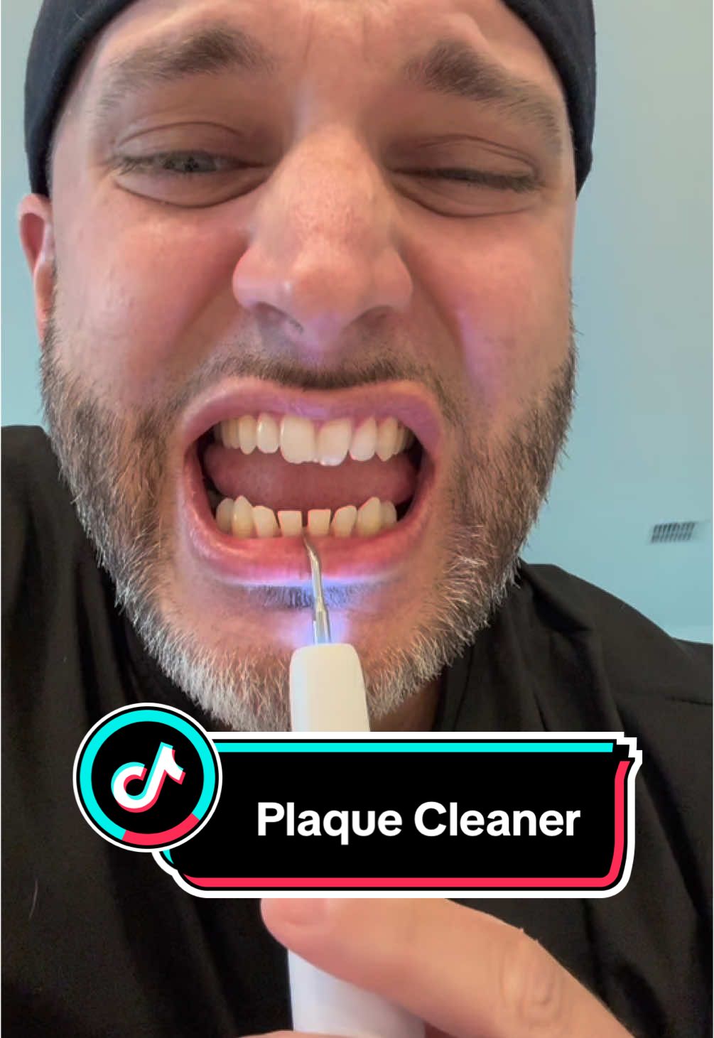 Finally got me one of those plaque cleaners that the dentist used. This is soo great! #plaque #plaquecleaner #teethcleaning #dentistry #treasurefinds #spotlightfinds #ttsdelight #giftguide #ttsdelightnow #tiktokshopcreatorpicks #ttslevelup#tiktokshoprestock #tiktokshopspringglowup #springtok 