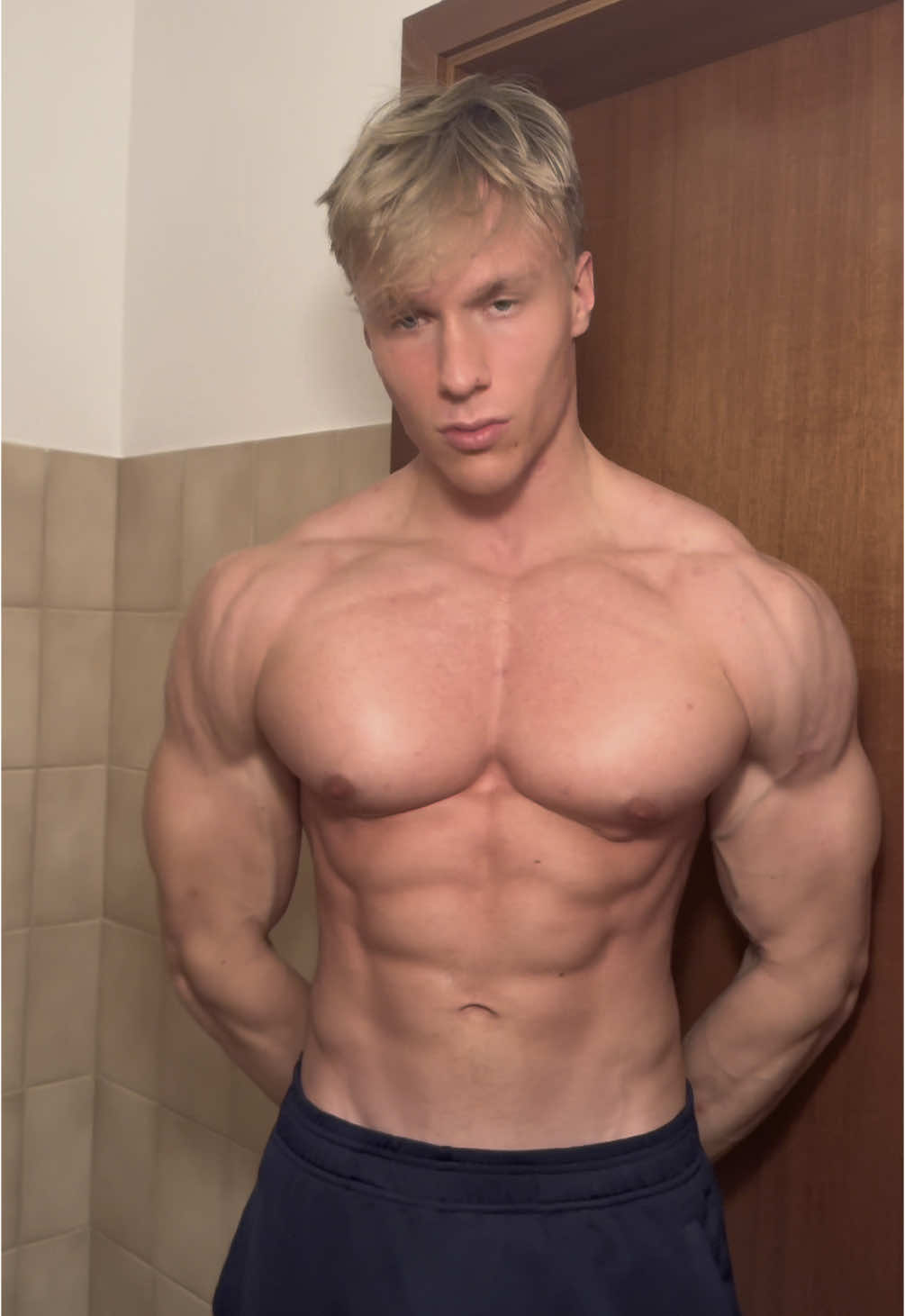 tb 