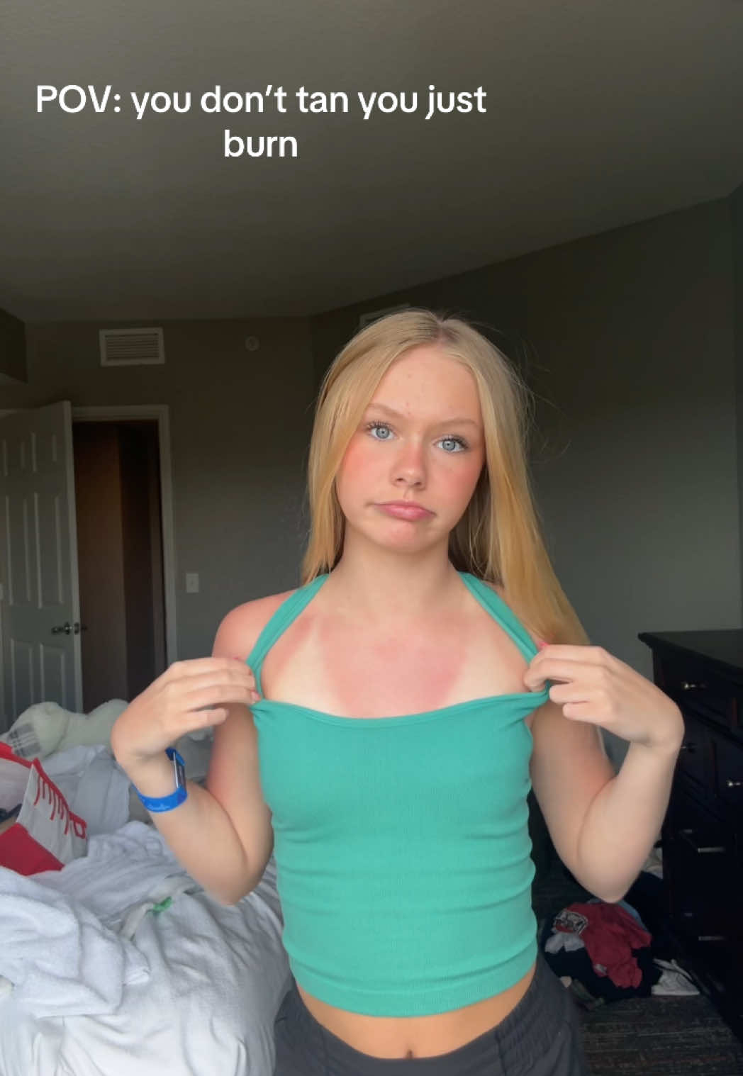 Dead #burnt #tanning 
