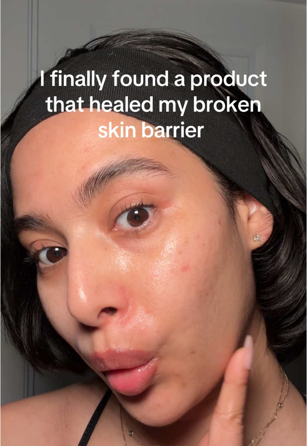 Having a good skin barrier cream completely transformed my skin🙌🏽 #skinbarrier #skinbarrierrepair #skintransformation #skincare #kbeauty 