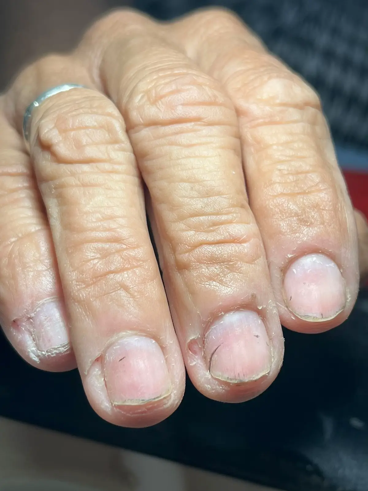 #cambio #cambiodelook #uñas #uñasacrilicas #uñas💅 #uñasdecoradas #nails #nailsartvideos #nailsart #nailsalon #manicura #manicurarusa #manicuraperfecta #manicuracombinada #profesional #manicurista #maxglow #viralvideos 