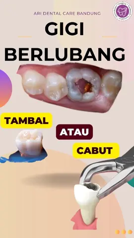 *Cungg yang sering bingung antara Tambal gigi🦷atau Cabut gigi🦷??🤔 Nahh, ternyata semua Tindakan itu disesuaikan dengan kondisi Giginya loh😉. Yukk cek kondisi Gigi Kamu sekarang juga dan dapatkan Penanganan dan Perawatan yang tepat!!🥰 Hanya di Klinik Ari Dental Care✨* 📞 Hubungi kami untuk info dan reservasi!