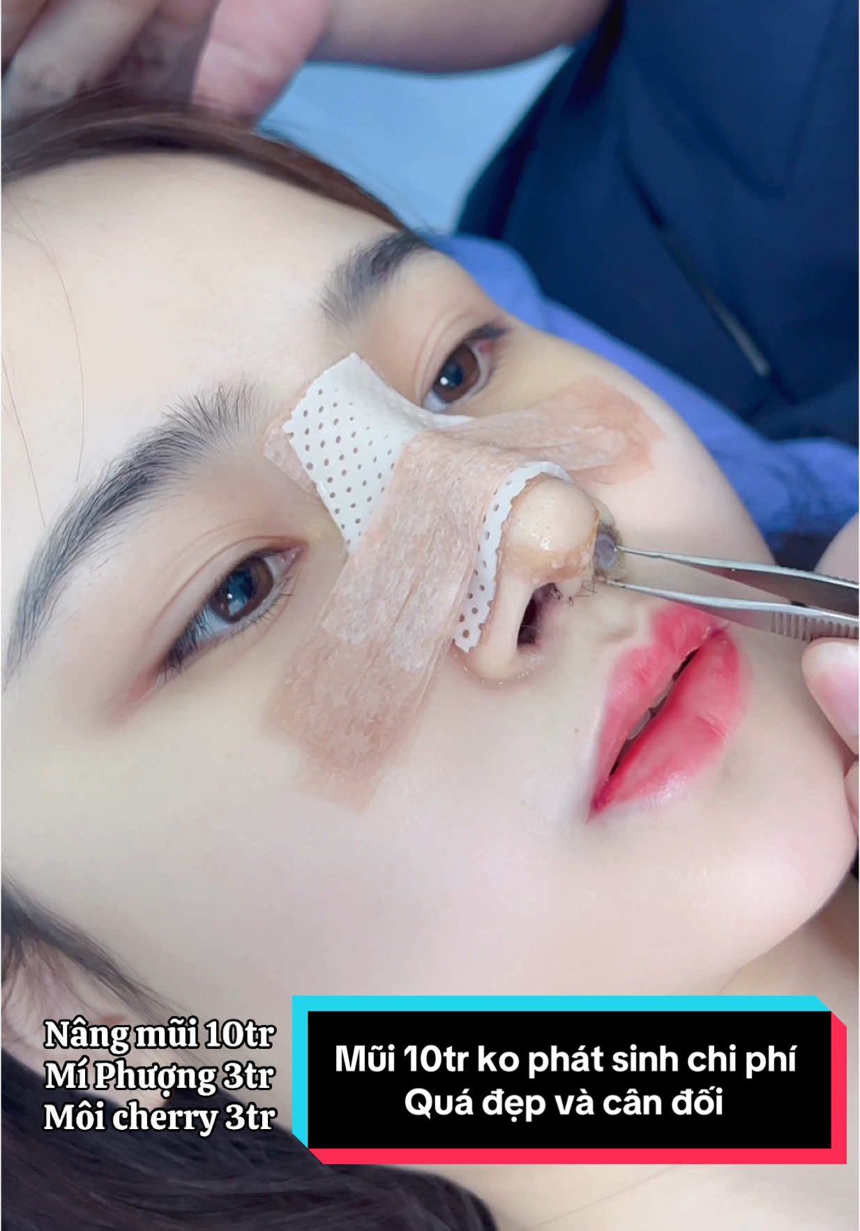 Trả lời @Bich Huong 碧香 TÁC DỤNG CỦA 2 BÔNG LỖ MŨI #xuhuong #LearnOnTikTok #nangmui #nangmuisline #nangmuiphongthuy #nangmuicautruc 