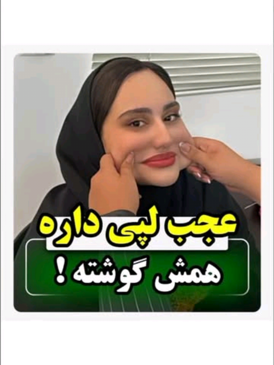 اگه تو هم میخوای صورت تپلی داشته باشی عدد ۴ رو برام کامنت کن. #beauty #foryou #افغانستان #explore #fyp 