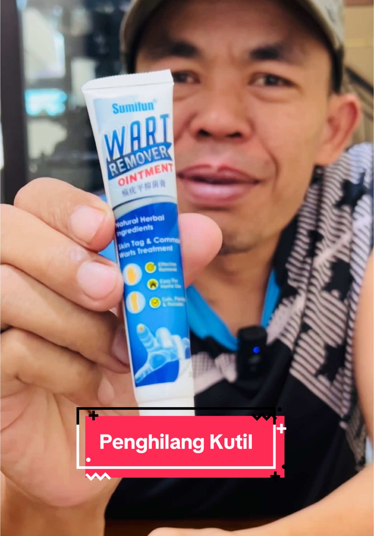 Penghilang kutil Bagus dan murah “ Sumifun Wart Remover” #penghilangkutil#kutil#sumifunkutil#carahilangkankutil