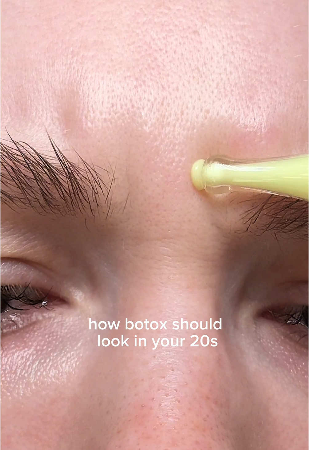 How botox should look in your 20s ✨  KSecret retinal eye serum 🤍 #retinal #botox #retinol #kbeauty #koreanskincare #ksecret #glassskin  @KSECRET GLOBAL 