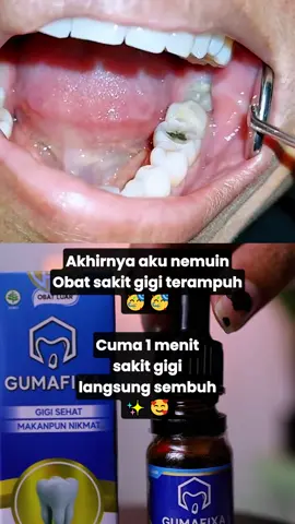 Kamu lagi nyari obat sakit gigi terampuh ?? udah langsung aja pake produk ini, sakit gigiku juga langsung sembuh !!! 🥰✨ #obatsakitgigiterampuh #obatsakitgigi #sakitgigi #gumafixa 