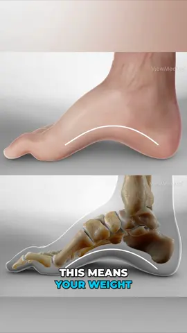 Pes cavus, also known as a high-arched foot, is a condition characterized by an abnormally high arch, leading to increased pressure on the ball and heel of the foot and potentially causing pain. #medicaleducation #medicalanimation #3danimation #3dmedicaleducation #3danimationsurgery