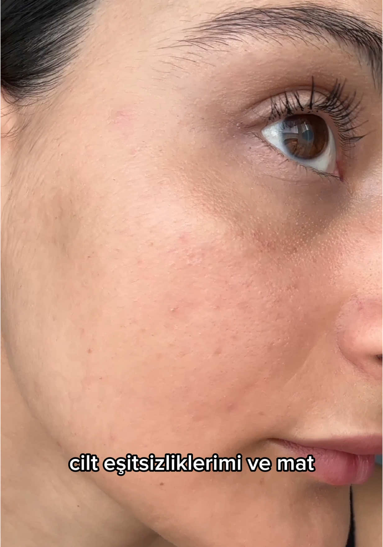 📌 reklam mecburi kendim satın aldım  . Ciltteki kırmızı akne lekeleri ve kahverengi güneş lekeleri bıyık lekeleri gibi sorunlarınızda bu ürünü kullanabilirsiniz arkadaşlar.  Bu ürünü kullandığımdan beri cildimin daha aydınlık ve parlak tek ton olduğunu düşünüyorum hem derinlemesine temizlik yapmış oluyorum.  Haftada 3 kere akşam rutinlerinizde kullanabilirsiniz✨ . . ✨✨✨ linkini ig öne çıkanlarıma ‘bubble’ olarak ekliyorum oradan ulaşabilirsiniz.🫧🫧🫧 #cilt #skincareroutin #ciltbakım #skin 
