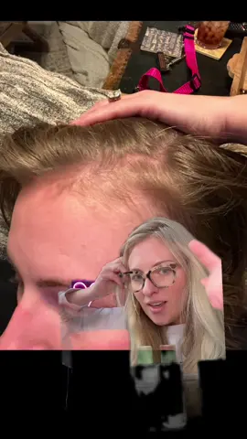 If you have been waiting for@Divi Scalp & Hair Health to be on sale, you won’t want to miss my live tonight! I will be going live on my personal page on April 9th from 7p- 9pm CST! I am also going to be giving away 5 scalp serums throughout my live!  #divi #scalpcare #hairlossjourney #hairthinning #thickhair #greenscreen 