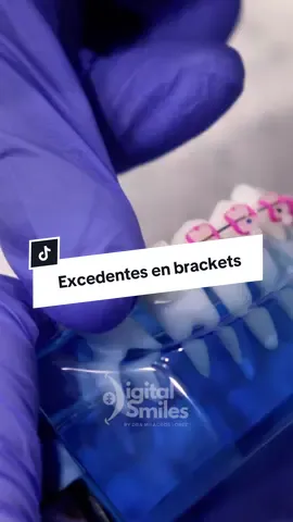¿Siempre te lastiman los excedentes después de tu control de brackets? Aquí tienes 03 soluciones para evitarlo 🥹✨ #brackets #braces #dolor #herida #arcos #ortodoncia #viral #viralvideo #fypp