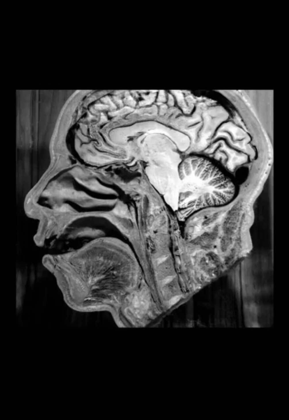 My next piercing #nextpiercing #lobotomycore #lobotomy 