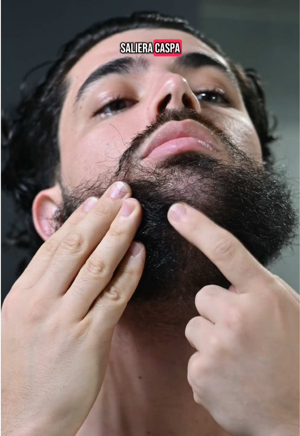 Caspa en la barba y como mejorarla  #caspa #dandruff #dandruffremovel #hairlossremedy #hairgrowth #hairproducts #barba #barbon 