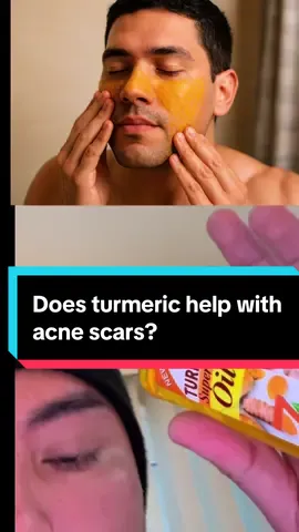 Best investment for summer #C#ClearSkinJourneyD#DarkSpotSolutionC#ClearSkinJourneyS#SkincareFromWithin