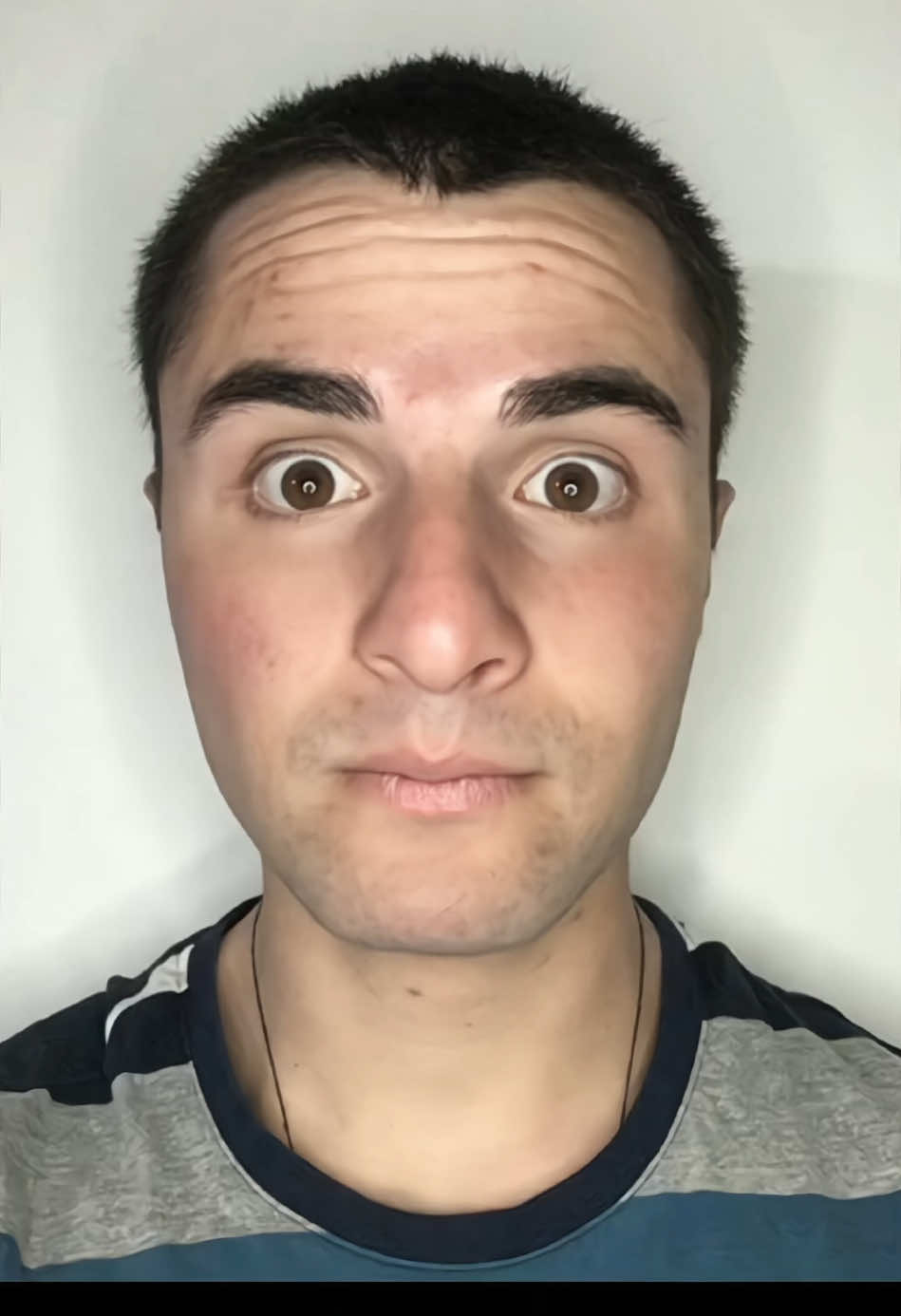 🔗 LINK NA BIO  Ative o crescimento da sua barba agora! 🔝 	 Barbudom MXD 20%: resultado real em até 100 dias 🚚 Entrega em até 24h | Pague na entrega! #barba #minoxidil #capilar #cabelos #calvice 