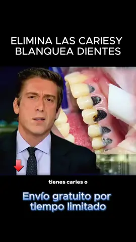 Prevénlo rápidamente antes de que se produzcan caries dentales. #CuidadoBucal  #freshmile #freshmileoralcare #freshmiletoothpastetables #dental #fyp #SonrisaSaludable #HigieneBucal