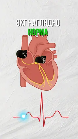 Все и без текста понятно:)