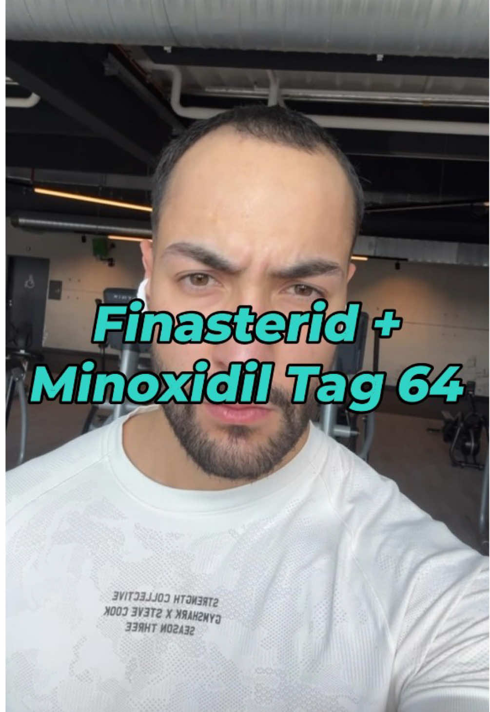 Tag 64 meiner Haarausfall Reise, Tonsur ist fast komplett dicht und die Geheimratsecken wachsen langsam nach 👀 Hinweis: Die in diesem Video gezeigten Informationen und Tipps ersetzen keine ärztliche Beratung. Medikamente und medizinische Eingriffe, sollten nur nach Rücksprache mit einem qualifizierten Arzt in Betracht gezogen werden. Jedes Verfahren und jedes Medikament kann individuelle Risiken und Nebenwirkungen haben. Eine professionelle Beratung ist wichtig, um sicherzustellen, dass die Behandlung für dich geeignet ist und um mögliche Komplikationen zu vermeiden. Für mehr Haarausfall Content, folge mir @safoshair gerne. #haarausfall #haarwachstum #haarpflege #haircare #haarverlust #haare #finasterid #minoxidil