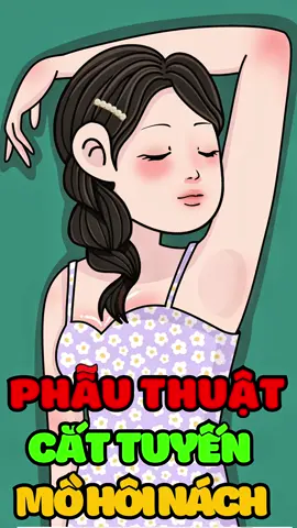 Phẫu thuật cắt tuyến mồ hôi nách