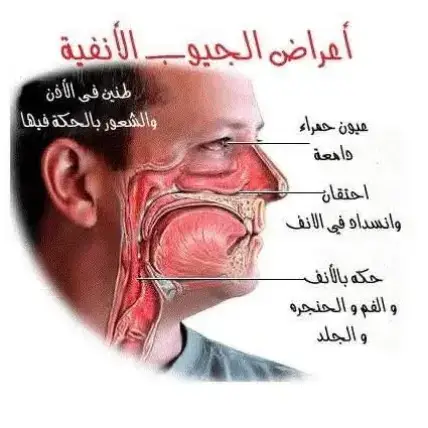 الشخص المريض بيكون عنده الاتي :😓 1- صداع نصفي مؤلم علي فترات 2- مشاكل ابدية في التنفس و خصوصا لو كان يعاني من زيادة الوزن 3- اعراض برد طوال العام مع اقل رطوبة او ملابس خفيفة 4- عصبية ناتجة من صعوبة التنفس و الصداع 5- تزداد الحساسية في الفترات بين الفصول الاربعة بالذات 6- الاتربة و الروائح تؤثر دايما علي التركيز و تسبب العطس المستمر 7- احيانا لا يستطيع استصاغة الاكل و لا يشعر بطعمه 8- التهاب مزمن في الحلق 9- الدخان يسبب له اختناق 10- اوقات سمعه بيتقل و يرجع تاني و بيسمع صفارة في ودانه كتير 11- معظم الوقت عظام الوجه تسبب له الم حاد ثم صداع 12- ممكن مع زيادة الحساسية عينيه كمان تسبب له وجع 13- حرقان دائم في المناخير.. ( و لا كأنه مدمن ) 14-صعوبة في التنفس ** مريض الحساسية بيفضل يعاني الاعراض دي طول حياته .. و بيتعود علي الحساسية لانه خلاص بيمل من الادوية 