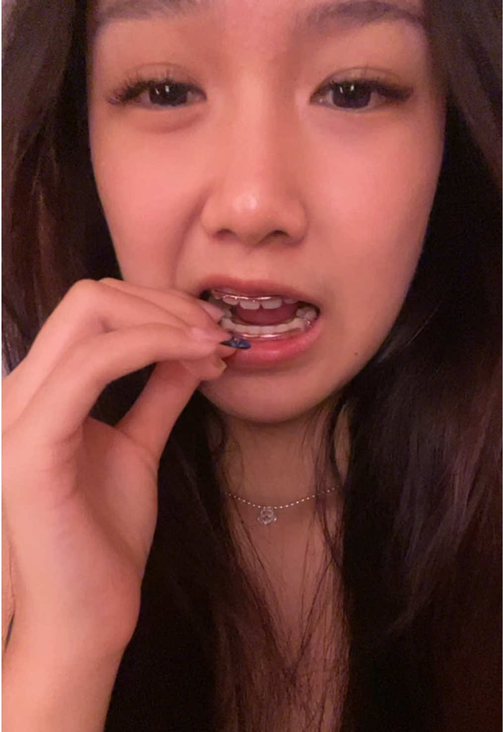 อะไรติดฟัน#07 