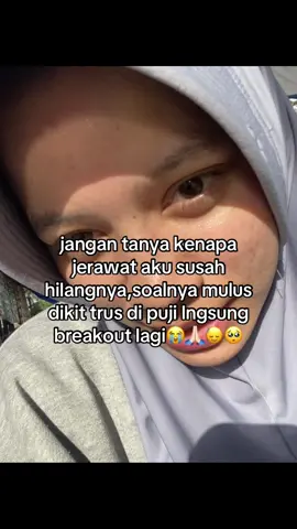 di puji dkit lngsung jerawatan lagi #fypage #skincare #jerawat 