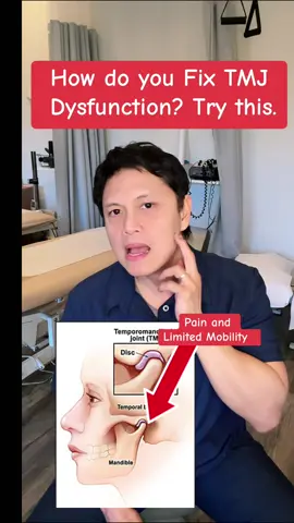 How do you Fix TMJ Dysfunction? Alleviate Jaw pain and Improve Jaw opening. #jawpain  #jawpainrelief #tmj  #physicaltherapy  #everyone 