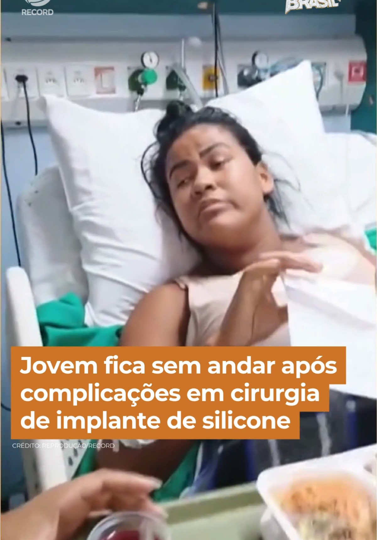 Jovem fica sem andar após complicações em cirurgia de implante de silicone. A mulher juntou R$ 20 mil  para realizar o sonho de colocar a prótese, mas o procedimento não aconteceu da maneira esperada. A médica responsável custeou um mês de internação da paciente em um hospital particular, para tratar de infecções contraídas, mas depois disso não prestou o apoio esperado pela família. A polícia investiga o caso, que foi registrado na delegacia como lesão corporal #FalaBrasil  Veja essa e outras notícias em R7.com/falabrasil