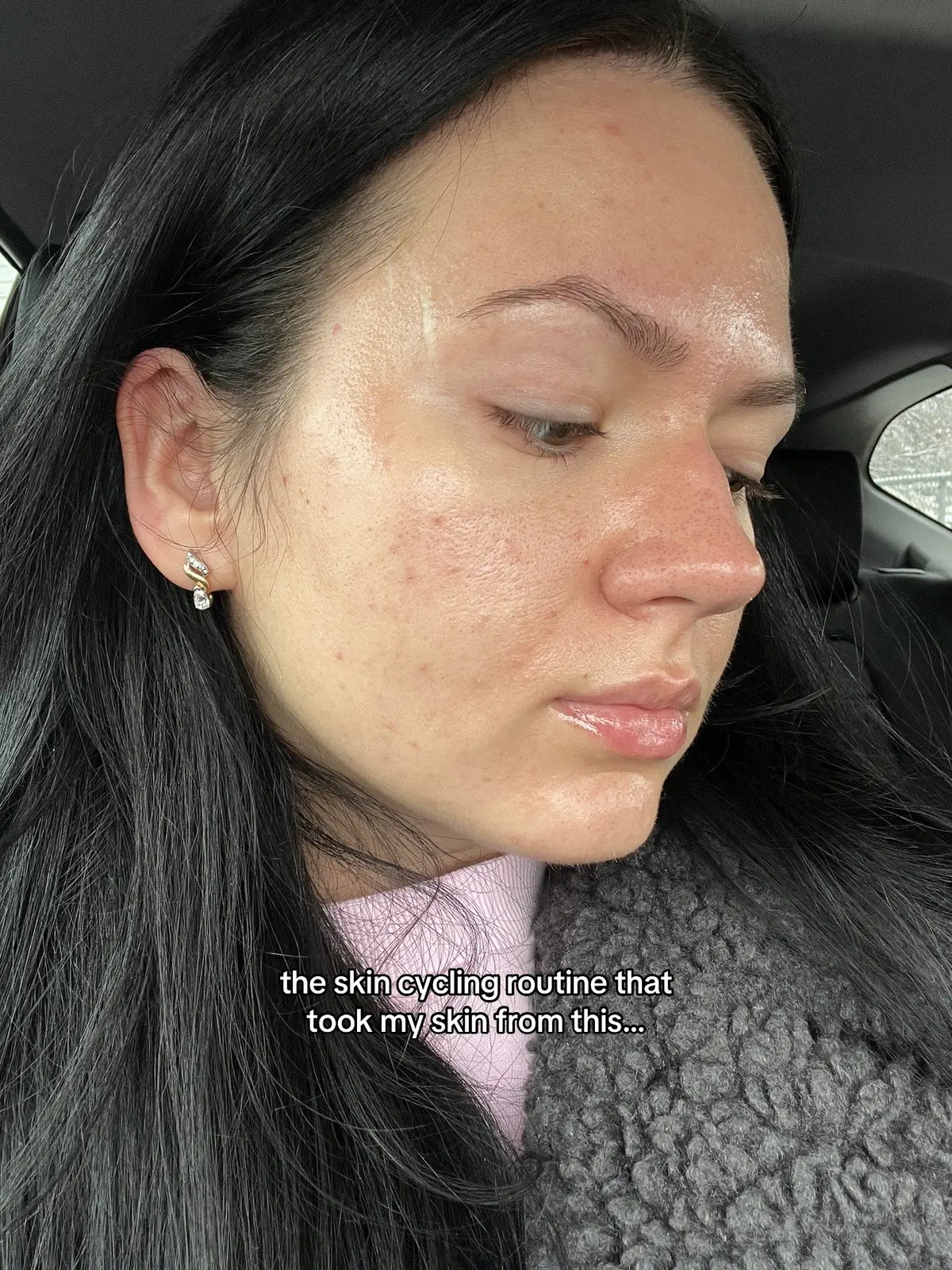 My highly requested skin cycling routine that completely transformed my skin🫧 #skincycling #skintok #acneprone #wellness #glassskin @Paula’s Choice @Caudalie @anua_global @Kiehl's Since 1851 @COSRX Official 