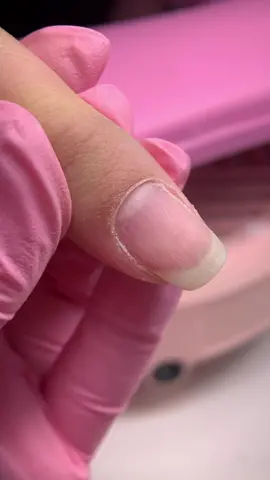 “Manicura rusa en seco: una técnica precisa y delicada que embellece tus manos sin tijeras ni corta cutículas. Acabado impecable, seguro y duradero… solo en Star Nails by Dayi.” Comenta la palabra “Clase” si les gustaría un video tutorial de esta técnica en vivo !!!!!!  Bits de @adez.professional  #Nailschool #nailsperfect #acrylicnails #nailss #nailsvideos #bronxnails #vietnails#acrylicnails #longnails #glitternails #fashionnails #nailsofig #ombrenails #nailschool #nailsperfect #acrylicnails #nailss #nailsvideos #bronxnails #vietnails# #starnails_by_dayi #acrylicnailsdesign #acrylicnailsextension #uñasesculpidas #star_nailsbeautysalon #nailsmiramar #nailspembrokepines #starbeautyspa_by_dayi #nailssunrise #nailsoaklandpark
