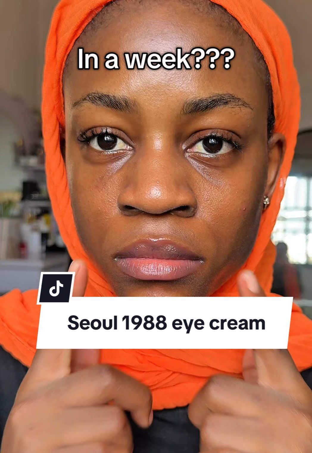 In just ONE week?? The Seoul 1988 Retinal Eye Cream visibly faded my dark circles and fine lines! It’s not just for under-eyes, this cream works wonders on wrinkles, pigmentation, and dark spots anywhere on the face. A little goes a long way@KSECRET GLOBAL    #glowupwithretinalchallenge #7daysglow #retinalglowup #secret #seoul1988  #hyperpigmentationtreatment #retinal #darkcirclestreatment #finelines #skincareroutines  #retinalcream #explore 