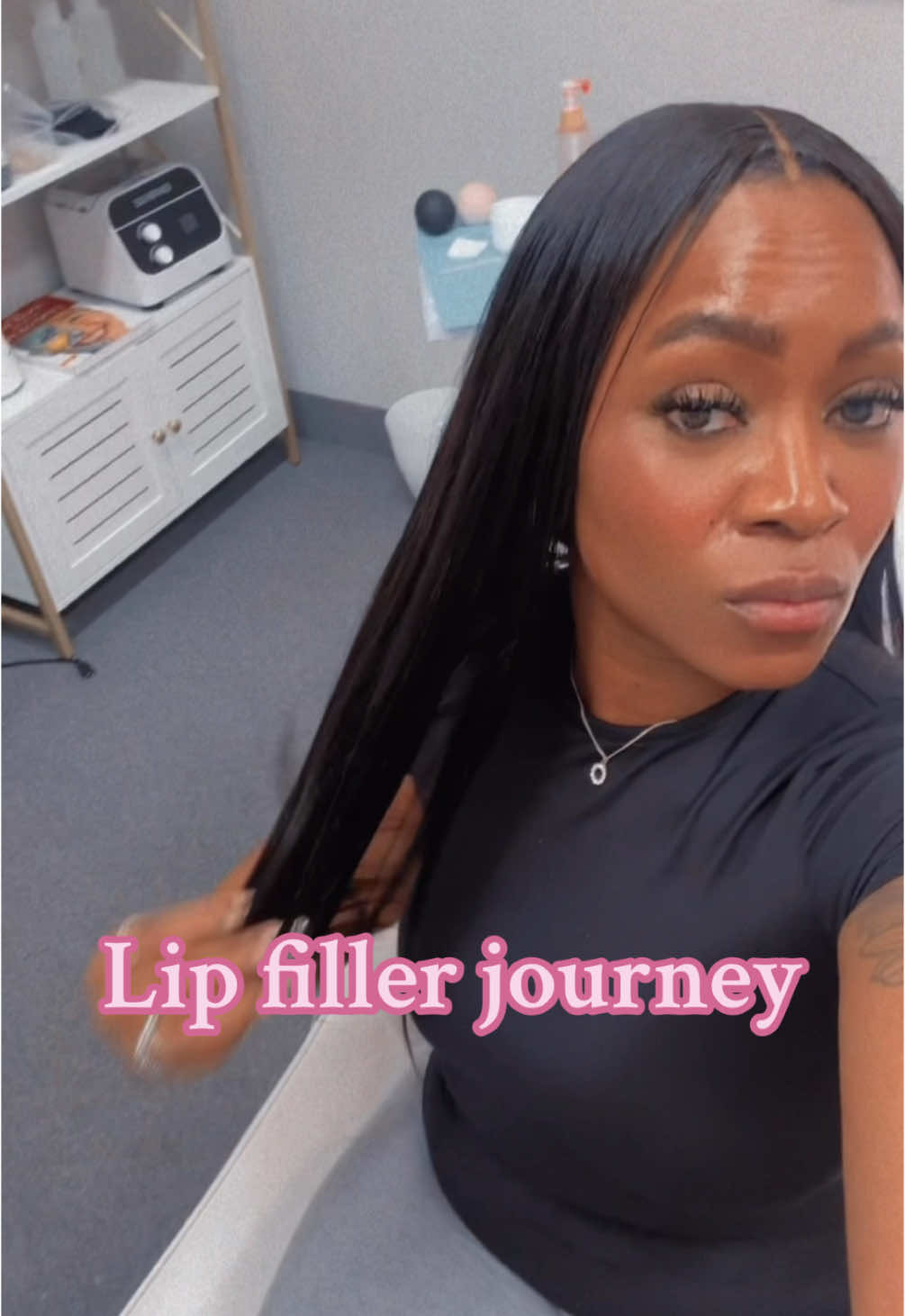 Lip filler before and after #lipfiller #blackgirllipfiller #tiktokaffiliateprogram #wiginfluencer #beautyhacks #nyxcosmetics 