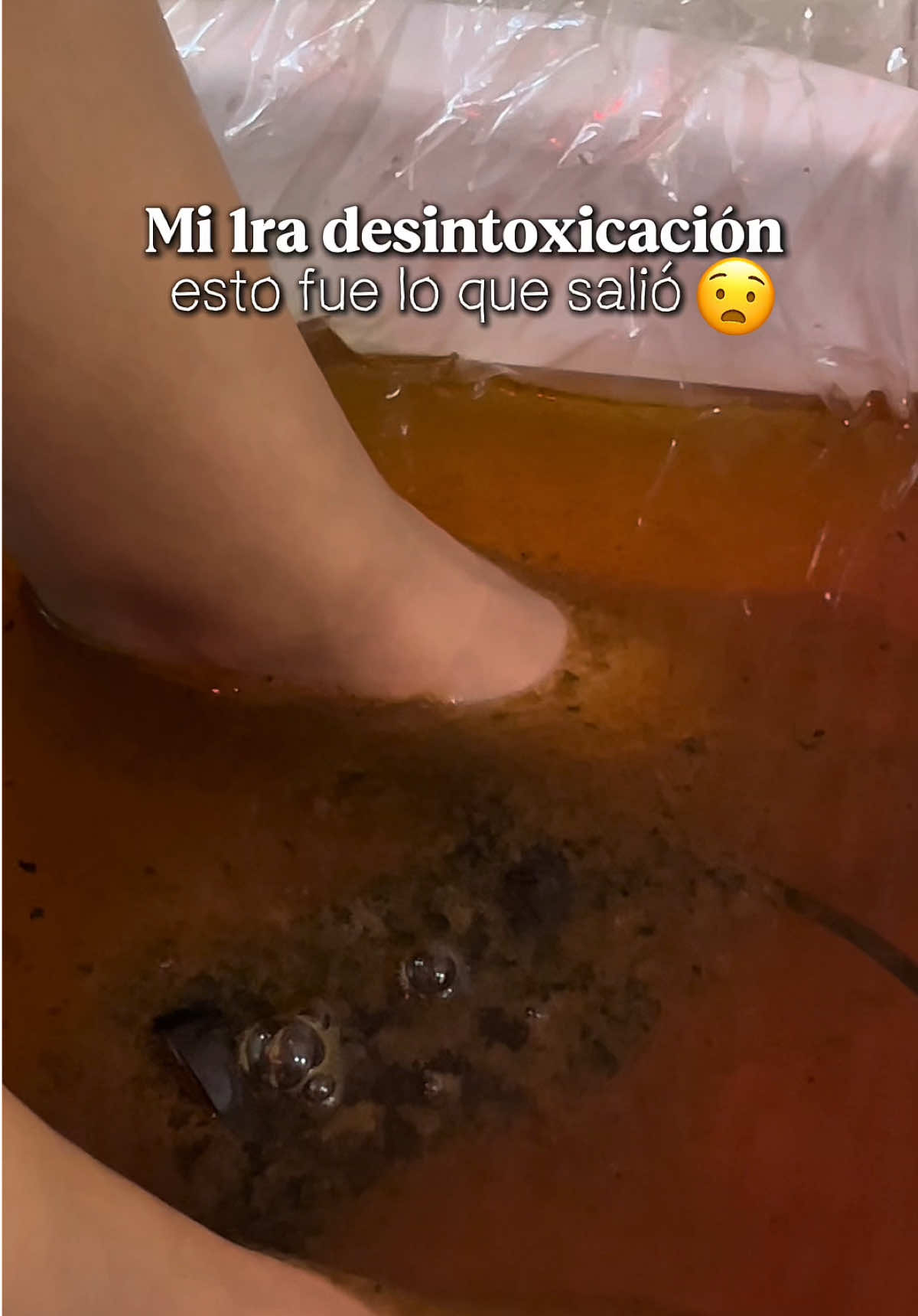 Así fue mi primera desintoxicación iónica el resultado me dejó 🤯🤯 @Dra. Mayra Lagos  #Detox #bienestar #desintoxicatucuerpo #spa #cucuta #fyp 