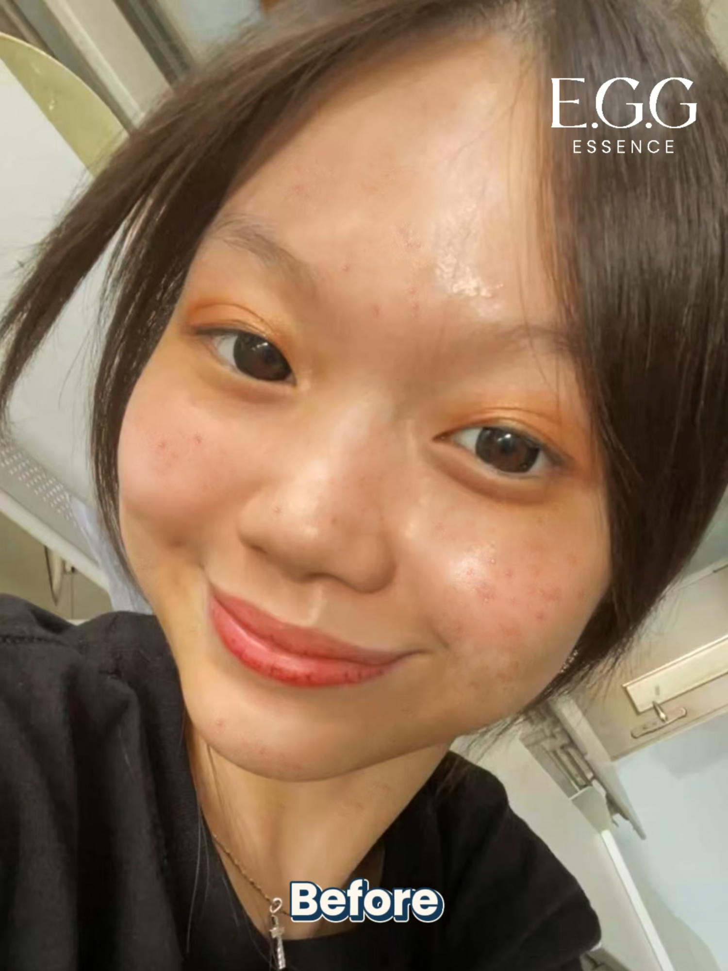 Perawatan simpel, hasil maksimal! Cukup pakai Egg Eggshell Mask 2x seminggu, kulit langsung beda! Yuk cobain sekarang! Disclaimer: hasil penggunaan product ini bisa berbeda-beda pada setiap individu. #tiktokshopfindsfyp #tiktokshopproducts #viralmask #skincare #glassskin #maskerantitua #maskerantiaging #maskerkerutan #fypシ #peeloffmask #maskerwajah #fyp #maskerviral #maskerglowing #egg