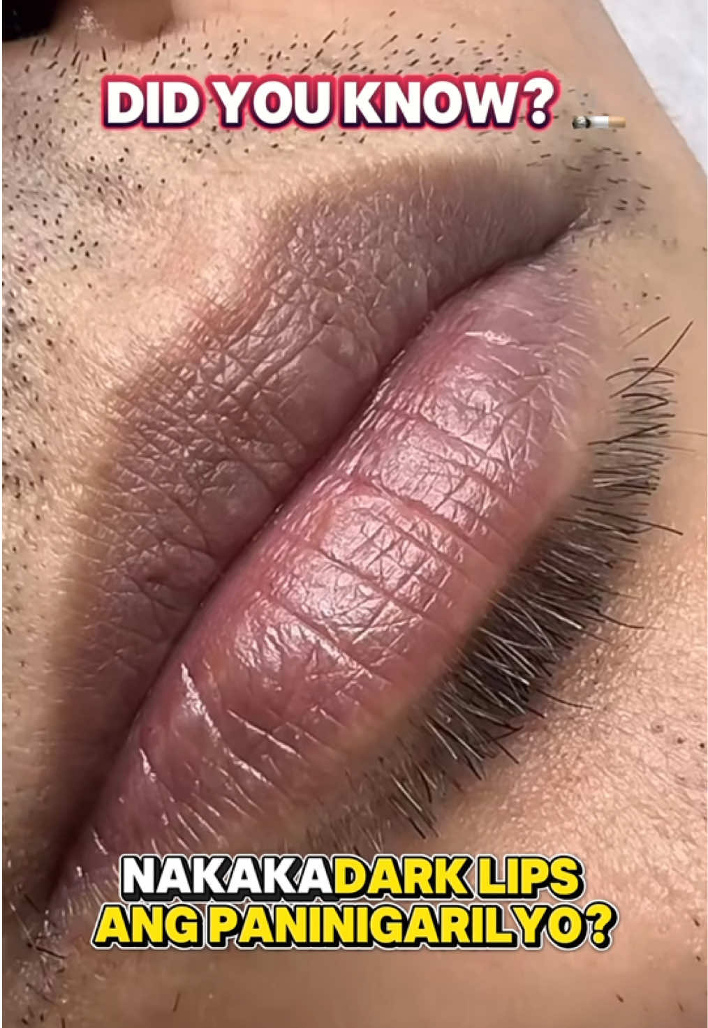 Alam mo bang nakakaitim ng labi ang paninigarilyo??  #dark #lips #men #spf 