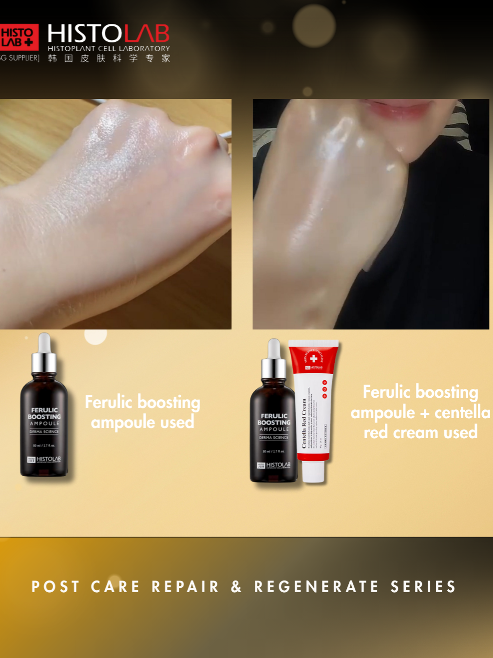 C + E Ferulic Acid Ampoule +contains 35%Centella asiatica ingredient {Moisturizing Regenerating Cream can immediately improve fine lines, wrinkles, baggy and dull skin and enlarged pores while also increasing the luminosity of your skin histolabsg #Singapore, Beauty WholesalerDermatology cosmetics brand Why you should use HISTOLAB FERULIC ACID 1️⃣ Contains 1% ferulic acid A powerful antioxidant 2️⃣Contains 7% vitamin C 3️⃣Contains 1% vitamin E 4️⃣Strengthens the skin barrier to prevent oxidation of active ingredients 5️⃣Antioxidant and whitening at the same time! 6️⃣Brightens and improves skin tone from within Beauty salons, dermatologists, skin management centers, etc., please contact us via WhatsApp 82466657 微信82466657 #SG beauty salon #SG medical beauty clinic #SG medical skin care products #SG Beauty Supplier #SG Skin Care Wholesaler #SG Beauty Wholesaler #Histolab Dermatology #Singapore Beauty salons #skinmanagement。 #Korean skin care products #Laser, repair and regeneration after wmedical beauty Plant stem cells #anti-wrinkle and anti-aging #whitening and skin rejuvenation # korean treatment #acne #dermatologyt #Vita C Complex Ampoule 47% #EGF Complex Ampoule 50% #Azulene Complex Ampoule 72 #Hyaluron Complex Ampoule 62 #BIO STEM CELL AMPOULE #Sensitive sun block forever #BB & Sun Care #Post Laser Sun Blemish Post #Laser Sun Block 365 Plus #Sun Shine Blemish Balm #Ceracles Water Cream #Hydrogel Regenerating Centella Cream #Post Care Histo Cell Cream #Red Out Histo K Cream #WaterMax hydrating Moisturizer #Premium Renewal Essence #AQUA AMPOULE MASK 62 #HISTOLAB Triple Moisturizer All-over Cream #Azulene DNA Cream #Azulene Toneup Cream #HISTOLAB Peel #PHA、AHA、BHA #Ferulic Acid Antioxidant #Laserrepairandregenerationaftermedical #Plantstemcells #anti-wrinkleandanti-aging #whitening #skinrejuvenation #koreantreatment #acne #dermatology #VitaCComplexAmpoule47% #EGFComplexAmpoule63% #azuleneampoule #Hyaluron #BIOSTEMCELLAMPOULE #sensitiveskin #sensitivesunblockforever #SunCare #Ferulic #repairskin #Antioxidant #BB