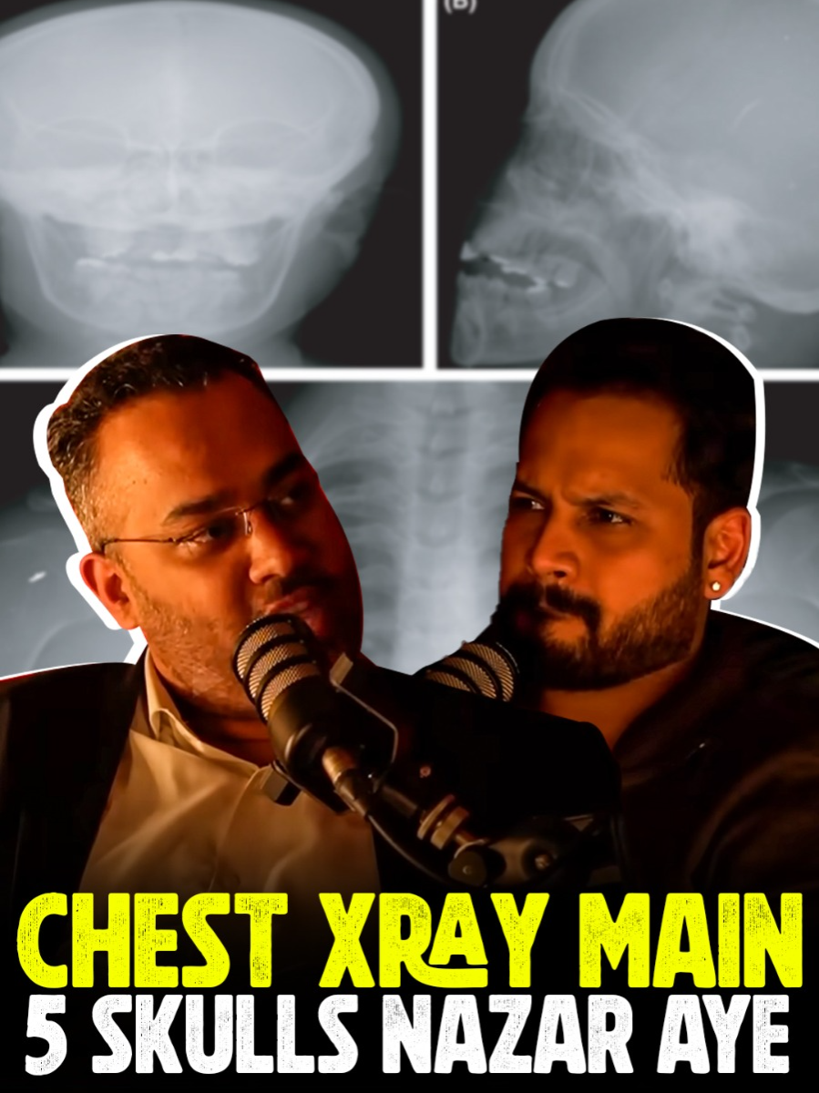 Chest Xray main 5 skulls nazar thy ft. Dr. Farrukh Shah #djinn #hauntedstories #paranormalactivities #horrorpodcast #azlanshah#whattowatch