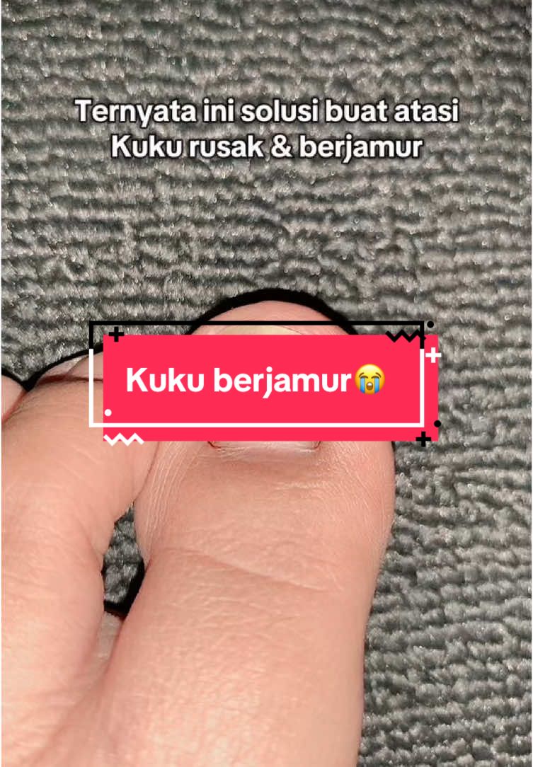 Untuk hasil tiap orang bisa berbeda -beda yaa tergantung kondisi kuku masing masing #perawatankuku #kukusehat #serumkuku #rtopr #fyp #masukberandafyp #foryoupage 
