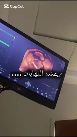 #رعشة_النهايات😢 #حوامل_اي_شهر_صرتو_🤰🤰😍🦋 #ولاده #حامل_وفي_الشهر_التاسع #حامل_بيبي #دياره_صبي #ترند_تيك_توك #هاشتاقات_تيك_توك_العرب #مشاهير_تيك_توك #مشاهداتكم⬆️⬆️⬆️⬆️⬆️⬆️ #الشعب_الصيني_ماله_حل 