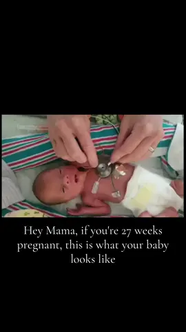 ##preemiebaby #nicu