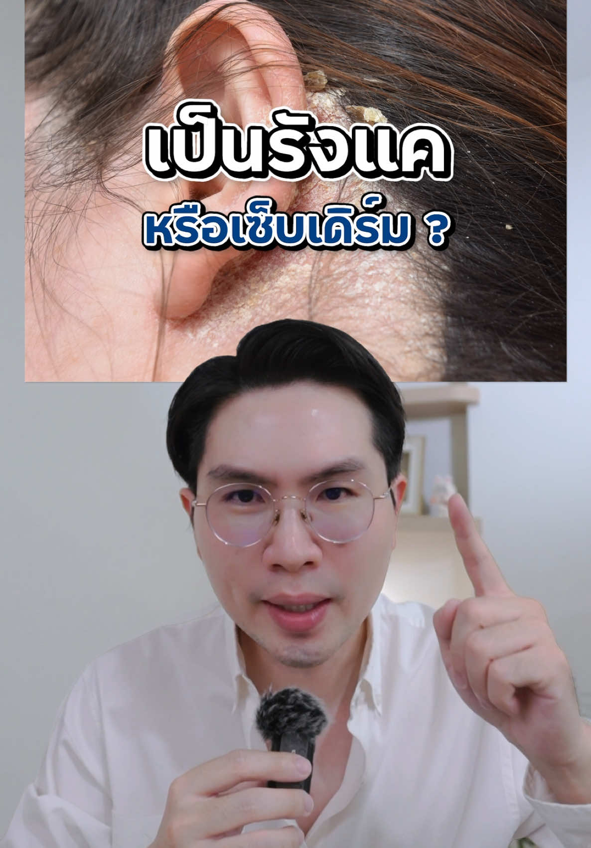 รังแค หรือ เซ็บเดิร์มที่หนังศีรษะกันแน่ ? #เปลี่ยนมาใช้เซลซั่นบลู #เห็นผลจริงใน2สัปดาห์ #SelsunblueThailand 