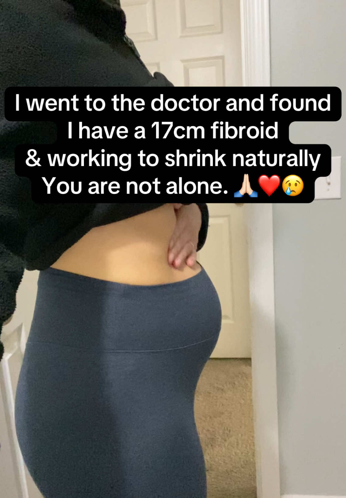 Some days are better than others but realizing your clothes do not fit the same and your stomach is always protruding is really hard on a girls self esteem 😢 if you are struggling from fibroids I feel you. 🙏🏻 #uterinefibroid #fibroids #hormonalimbalance 