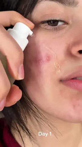 I’m in love😭💗#oliveyoungglobal #oliveyoung #kbeauty #koreanskincare @mixsoon_official #korea #morocco🇲🇦 #foryoupagee #fyp 