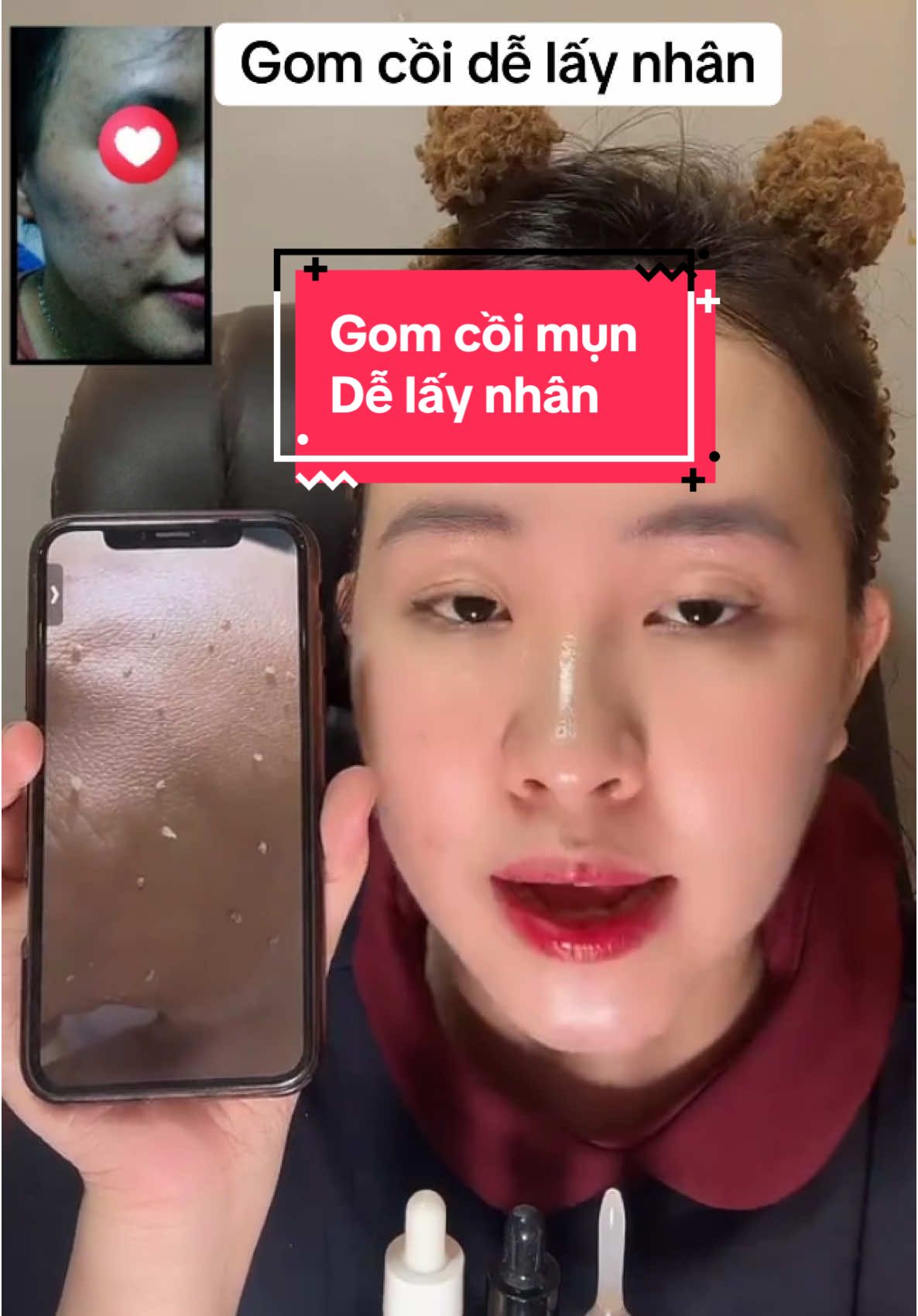 #gomcoimunsau3den10ngay #gomcoimunbenus #gomcoimun24h #chammunbenus #tinhchatgomcoimun 