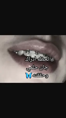 تقويم الاسنان🥹💗#العراق_الانبار #محمود_الجبليtiktokarabمشاهدات #fypシ゚viral #الشعب_الصيني_ماله_حل😂😂 #مالي_خلق_احط_هاشتاقات 