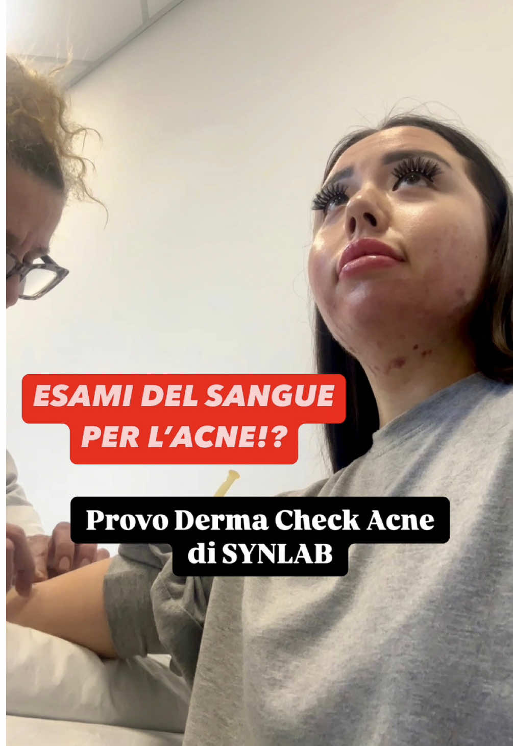 Grazie al nuovo test Derma Check Acne di SYNLAB possiamo finalmente capire qualcosa in più sulle cause della nostra acne! Derma Check - Acne è il nuovo pacchetto di analisi di laboratorio che permette di indagare gli squilibri ormonali e le carenze nutrizionali, tra le principali cause della comparsa dell’acne, dando inizio a un percorso di trattamento completo e personalizzato di questa condizione dermatologica. Sapevi che puoi farlo in tutti i centri SYNLAB d'Italia? Per scoprire di più al riguardo, cerca SYNLAB Derma Check - Acne su Google. Non nascondere l’acne, indagane la causa❤️ #ad #synlab #synlabitalia #dermacheckacne #nientedanascondere #acne #skin 