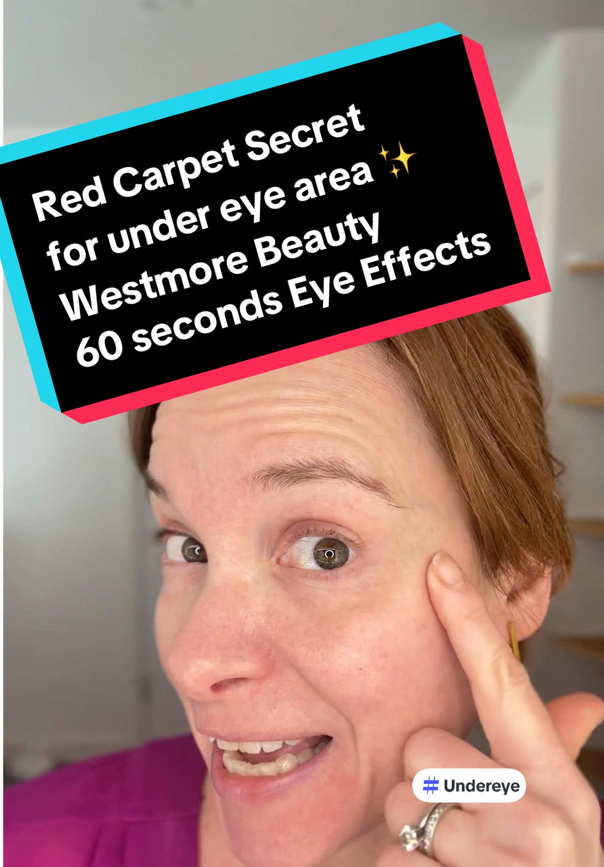 Here’s how celebs always look so well rested! Check out @Westmore Beauty #60secondeyeeffects while I test it on only one under eye. It smooths out my eye bags and dark circles. #eyebags #darkcircles #darkcirclesundereyes 