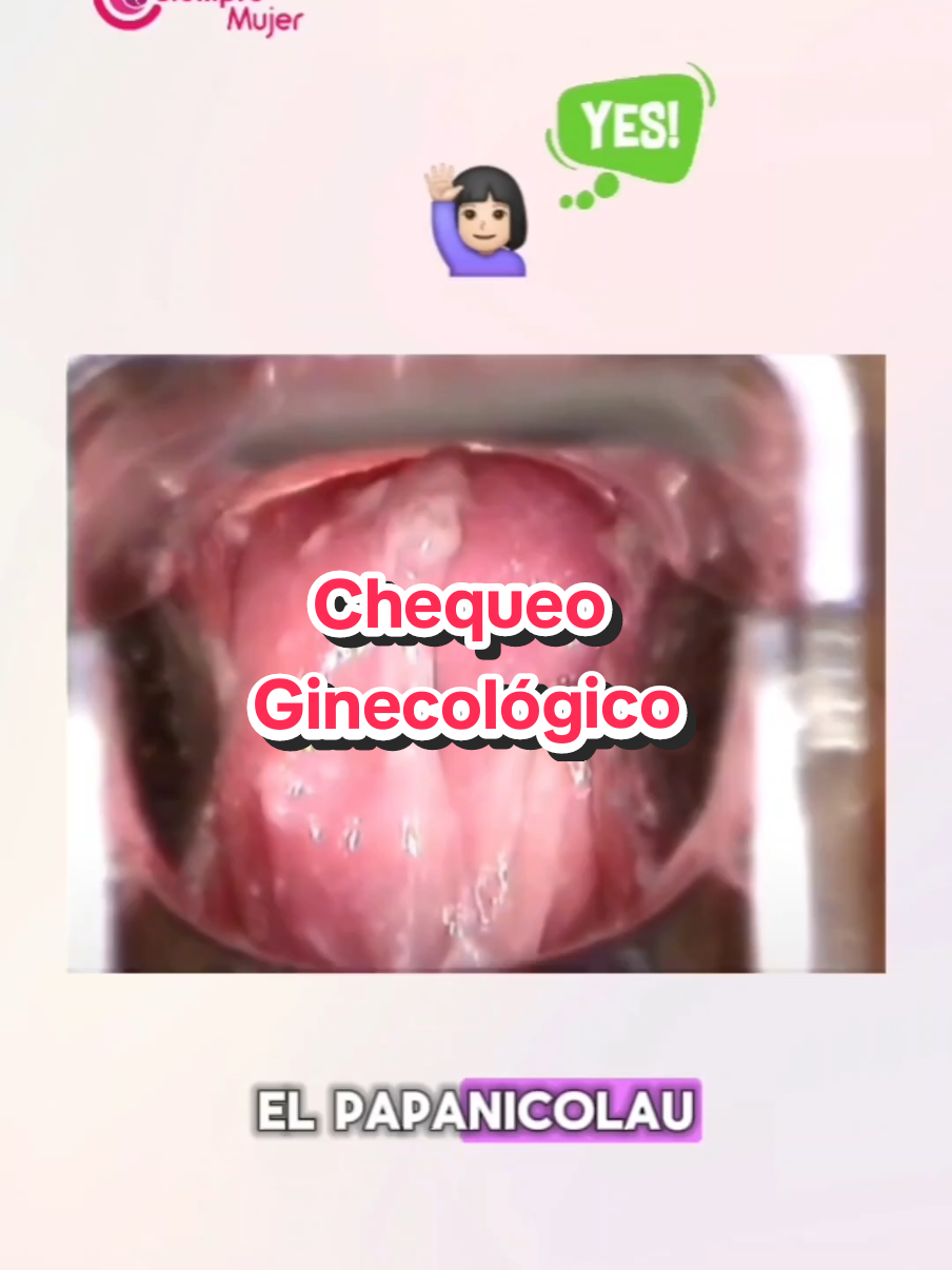 El Papanicolaou es un infaltable en tu Chequeo Ginecológico Preventivo, este examen se realiza una vez al año. 🥰 No permitas que nada afecte a tu salud de manera silenciosa 🚨, la prevención siempre sera una buena opción. ✨️ #papanicolaou #pap #cervix #citologia #cuellouterino #saludfemenina #ginecologia #obstetricia #Ginecólogos #vph 