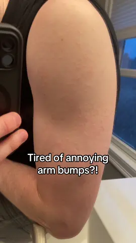 Get rid of them before summer! 
