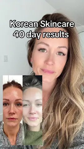 #KoreanSkincareRoutine #KBeauty 
